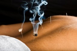 moxabustion is a technique that burns the dried herb mugwort to facility healing